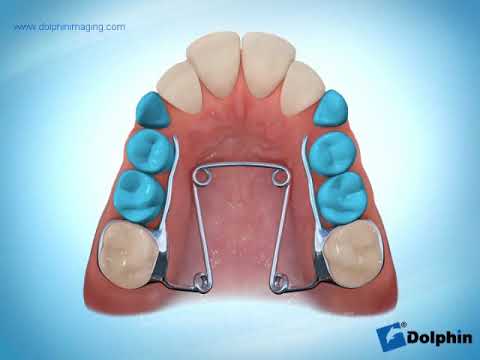 Miniature pour Le Quad Helix